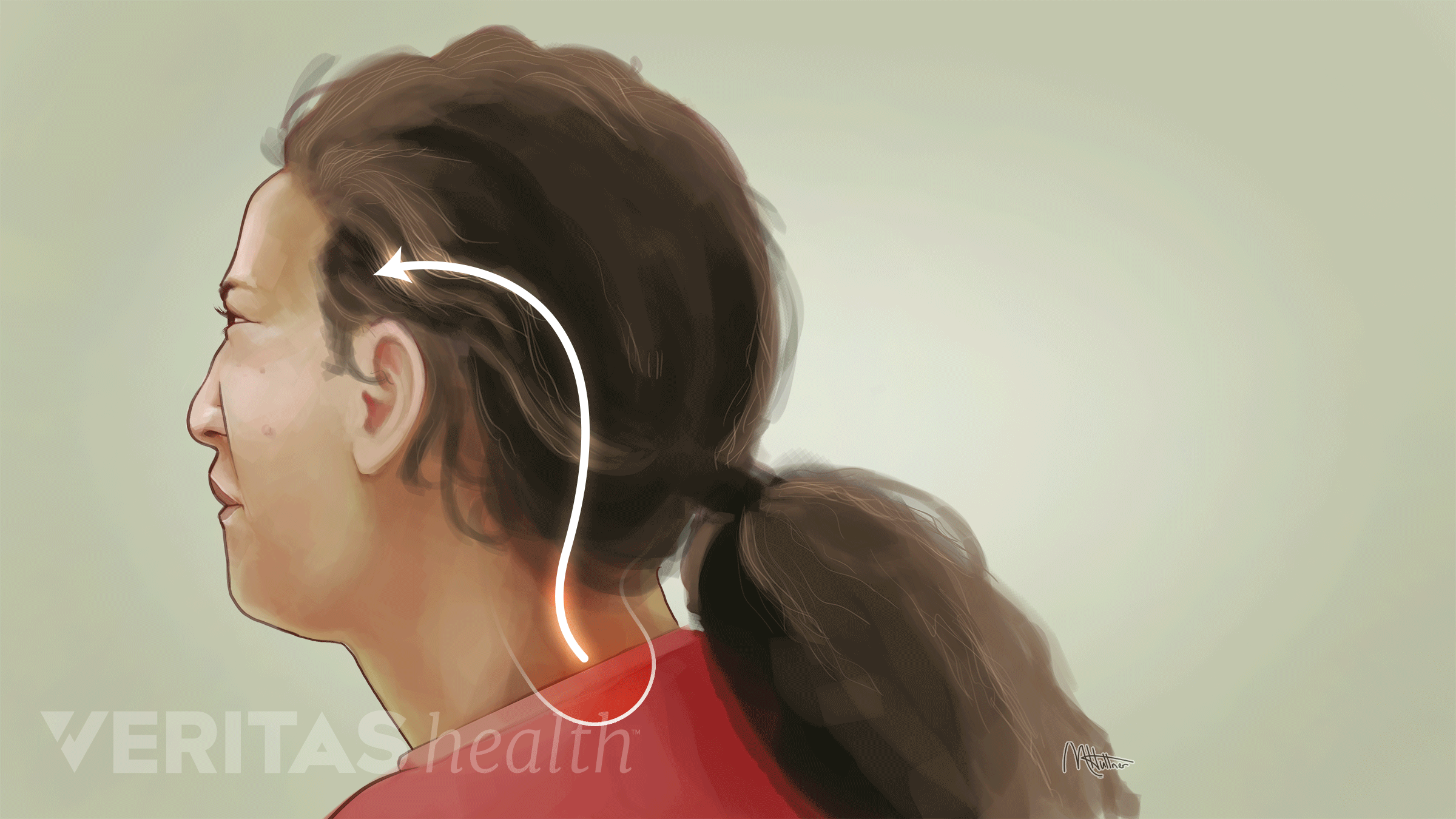 Occipital Neuralgia What It Is And How To Treat It Psjc