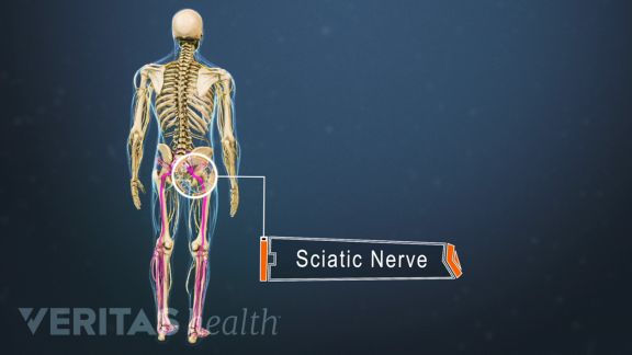 How Massage Can Ease Sciatic Pain - PSJC