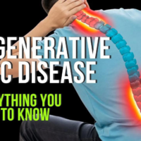 Degenerative Disc Disease - Everything You Need to Know - Princeton Spine & Joint Center - Dr. Grant Cooper